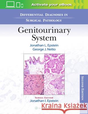 Differential Diagnoses in Surgical Pathology: Genitourinary System George J. Netto 9781975162900 Wolters Kluwer Health