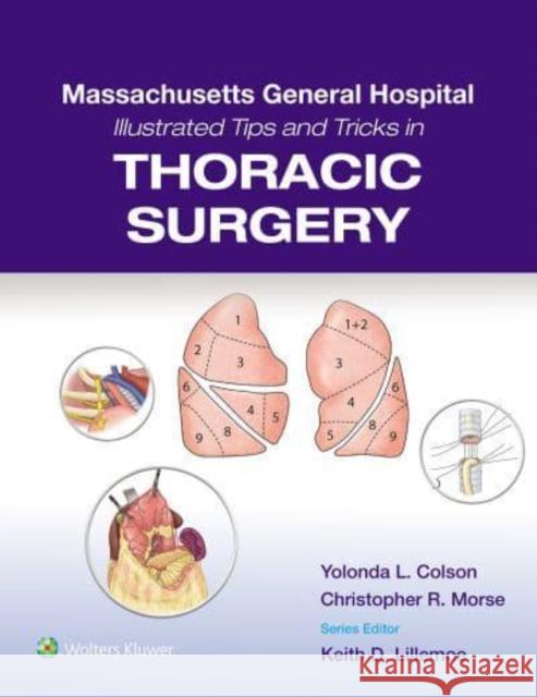 Massachusetts General Hospital Illustrated Tips and Tricks in Thoracic Surgery Yolonda Colson Christopher Morse 9781975171933 Wolters Kluwer Health