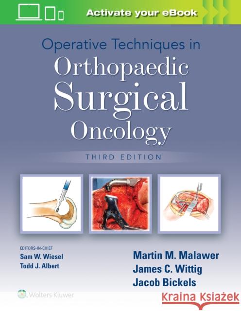 Operative Techniques in Orthopaedic Surgical Oncology Martin M. Malawer 9781975172084 