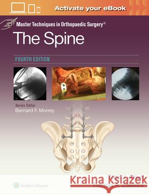 Master Techniques in Orthopaedic Surgery: The Spine Todd Albert Thomas A. Zdeblick 9781975175511 LWW