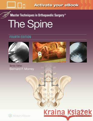 Master Techniques in Orthopaedic Surgery: The Spine Todd Albert Thomas A. Zdeblick 9781975175511