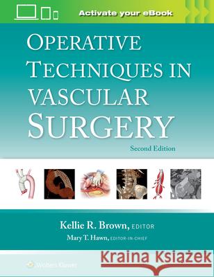 Operative Techniques in Vascular Surgery Kellie R. Brown 9781975176648 Wolters Kluwer Health