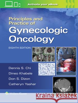 Principles and Practice of Gynecologic Oncology Dennis Chi Andrew Berchuck Don S. Dizon 9781975183271