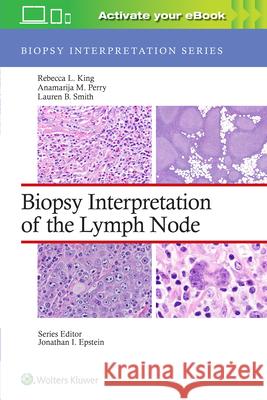 Biopsy Interpretation of the Lymph Nodes Rebecca L. King Anamarija M. Perry Lauren B. Smith 9781975184629