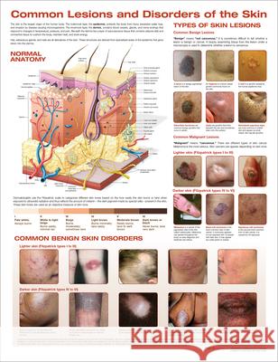 Common Lesions and Disorders of the Skin Anatomical Chart       Laminated Anatomical Chart Company 9781975191016