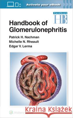 Handbook of Glomerulonephritis Patrick Nachman Edgar Lerma Michelle Rheault 9781975191061