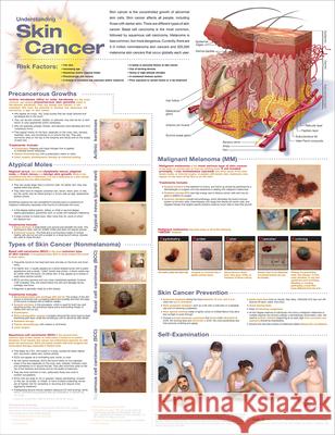 Understanding Skin Cancer Anatomical Chart Anatomical Chart Company 9781975192303