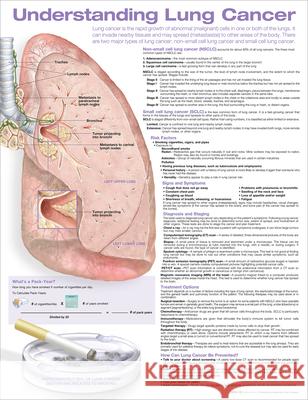 Understanding Lung Cancer Anatomical Chart Anatomical Chart Company 9781975192365