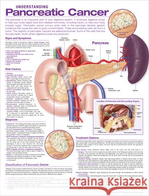 Understanding Pancreatic Cancer Anatomical Chart Anatomical Chart Company 9781975192389