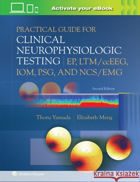 Practical Guide for Clinical Neurophysiologic Testing: Ep, Ltm/Cceeg, Iom, Psg, and Ncs/Emg Thoru Yamada Elizabeth Meng 9781975193577 LWW