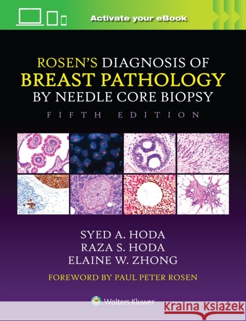 Rosen's Diagnosis of Breast Pathology by Needle Core Biopsy Elaine, MD Zhong 9781975198367