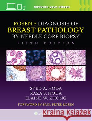 Rosen's Diagnosis of Breast Pathology by Needle Core Biopsy Elaine Zhong 9781975198367 Wolters Kluwer Health