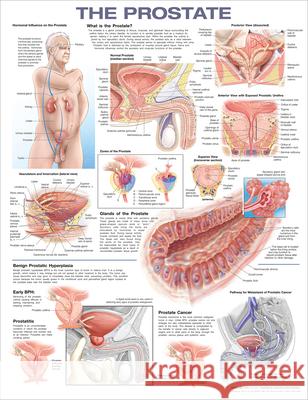 The Prostate Anatomical Chart Anatomical Chart Company   9781975198503 Wolters Kluwer Health