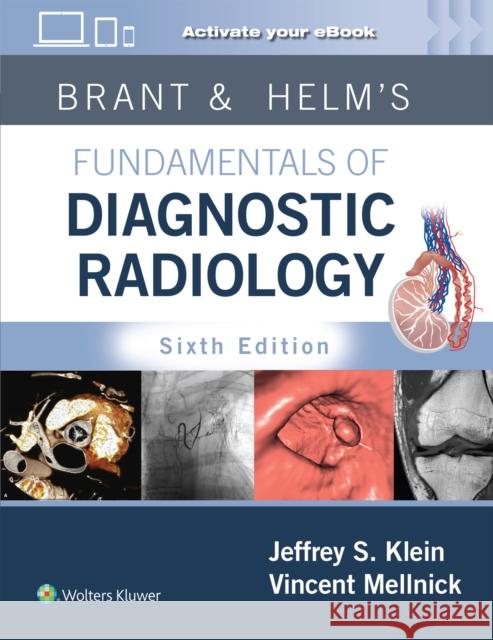 Brant & Helm's Fundamentals of Diagnostic Radiology: Print + eBook with Multimedia Jeffrey Klein Vincent Mellnick 9781975199005