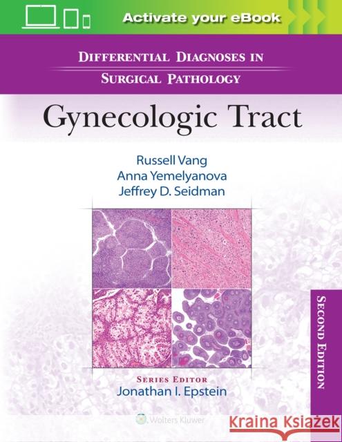 Differential Diagnoses in Surgical Pathology: Gynecologic Tract Jeffrey D., MD Seidman 9781975199012 Wolters Kluwer Health