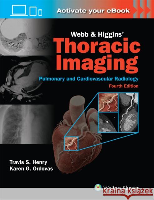 Webb & Higgins Thoracic Imaging: Print + eBook with Multimedia Travis Henry Karen Gomes Ordovas 9781975199388 LWW