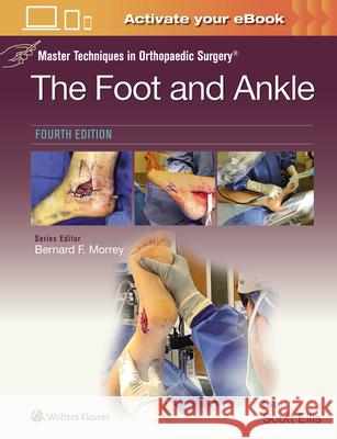 Master Techniques in Orthopaedic Surgery: The Foot and Ankle SCOTT ELLIS 9781975199418 Wolters Kluwer Health
