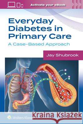 Everyday Diabetes in Primary Care: A Case-Based Approach Jay Shubrook 9781975209841 Wolters Kluwer Health