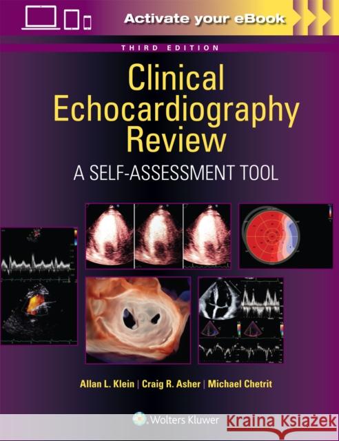 Clinical Echocardiography Review: A Self-Assessment Tool: Print + eBook with Multimedia Allan L. Klein Craig R. Asher 9781975211899