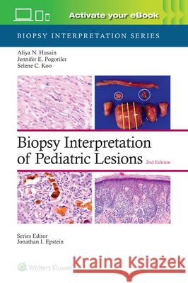 Biopsy Interpretation of Pediatric Lesions: Print + eBook with Multimedia Aliya Noor Husain 9781975213268 Wolters Kluwer Health