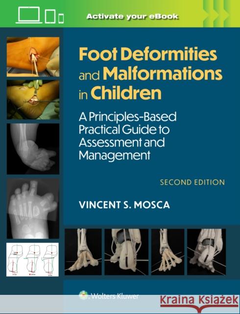 Foot Deformities and Malformations in Children: A Principles-Based, Practical Guide to Assessment and Management: Print + eBook with Multimedia Vincent Mosca 9781975213374 LWW