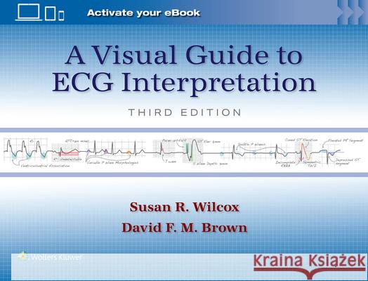 A Visual Guide to ECG Interpretation Susan Renee Wilcox David F. M. Brown 9781975213589 LWW