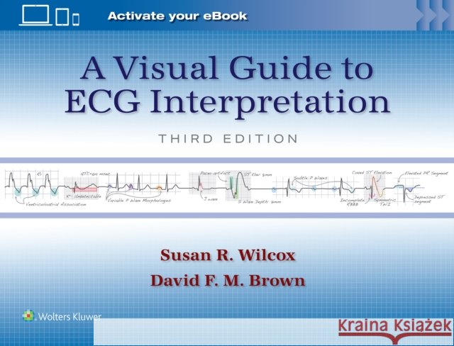 A Visual Guide to ECG Interpretation: Print + eBook with Multimedia DAVID F. M. BROWN 9781975213589 Wolters Kluwer Health