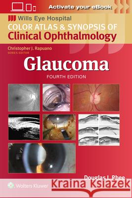 Glaucoma Douglas J. Rhee 9781975214814 LWW