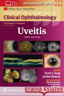 Uveitis Sunir J. Garg 9781975215194 Wolters Kluwer Health