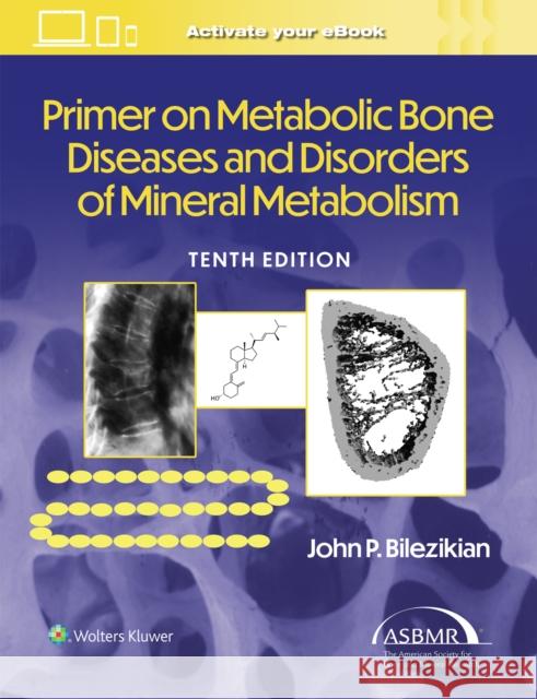 Primer on the Metabolic Bone Diseases and Disorders of Mineral Metabolism John P. Bilezikian 9781975215620 LWW