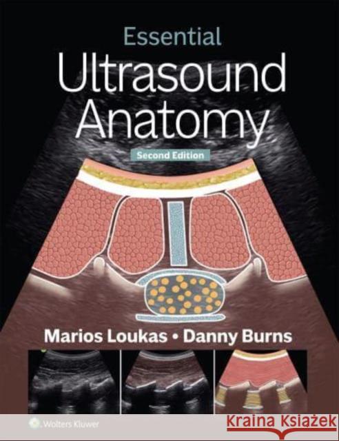 Essential Ultrasound Anatomy Danny Burns 9781975216887