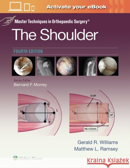 Master Techniques in Orthopaedic Surgery: The Shoulder Gerald R. Williams Matthew L. Ramsey 9781975217969