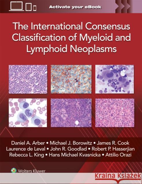 The International Consensus Classification of Myeloid and Lymphoid Neoplasms Daniel A. Arber 9781975222598