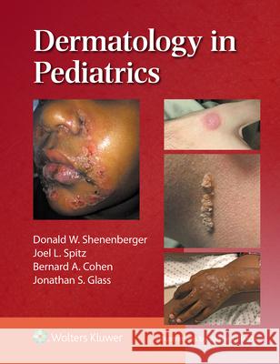 Dermatology in Pediatrics Shenenberger 9781975235383 Wolters Kluwer Health