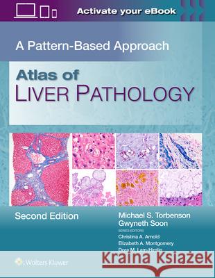 Atlas of Liver Pathology: A Pattern-Based Approach Michael Scott Torbenson Gwyneth Soon 9781975240110