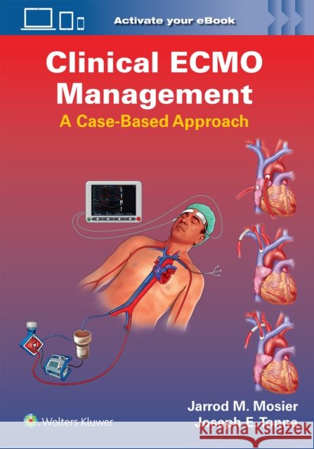 Clinical ECMO Management Joseph Edward, MD Tonna 9781975240141