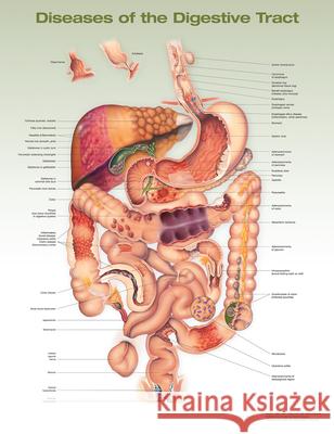 Diseases of the Digestive Tract Anatomical Chart Anatomical Chart Company 9781975243258