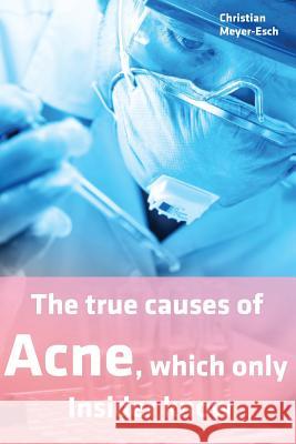 The true causes of Acne, which only Insider know Meyer-Esch, Christian 9781976457104 Createspace Independent Publishing Platform