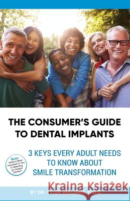 The Consumer's Guide to Dental Implants: 3 Keys Every Adult Needs to Know About A Smile Transformation Williams, Tyler 9781977207289 Outskirts Press