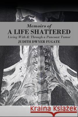 Memoirs of a Life Shattered: Living With & Through a Pancoast Tumor Judith Dwyer Fugate 9781977231505