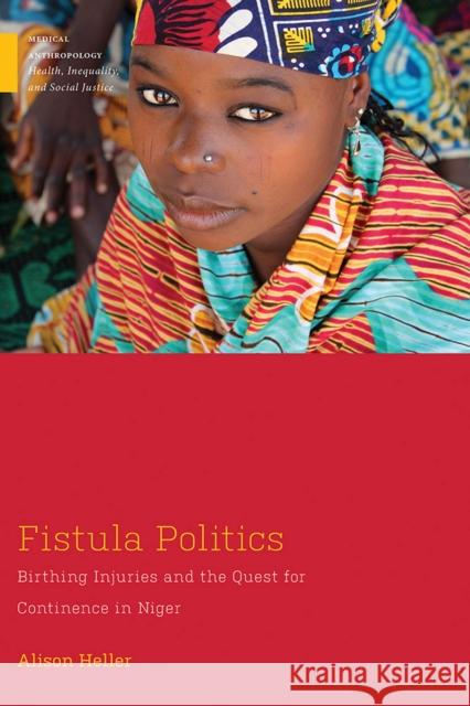 Fistula Politics: Birthing Injuries and the Quest for Continence in Niger Alison W. Heller 9781978800366 Rutgers University Press