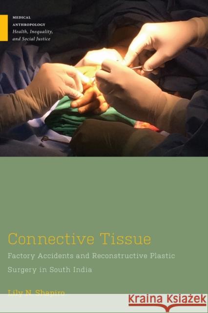 Connective Tissue: Factory Accidents and Reconstructive Plastic Surgery in South India Lily N. Shapiro 9781978841536 Rutgers University Press