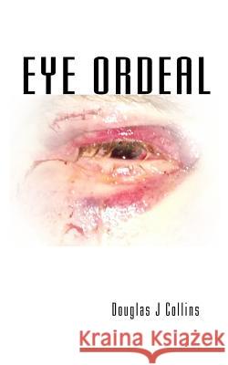 Eye Ordeal Douglas J. Collins 9781983603600