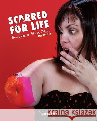 Scarred for Life. 2nd Edition: Every Scar Tells A Story Ted Meyer 9781985007321 Createspace Independent Publishing Platform
