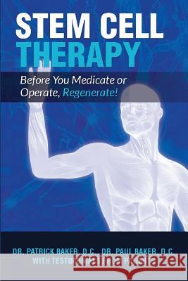 Stem Cell Therapy: Before You Medicate or Operate, Regenerate! Dr Paul Baker Dr Patrick Baker 9781985431379 Createspace Independent Publishing Platform