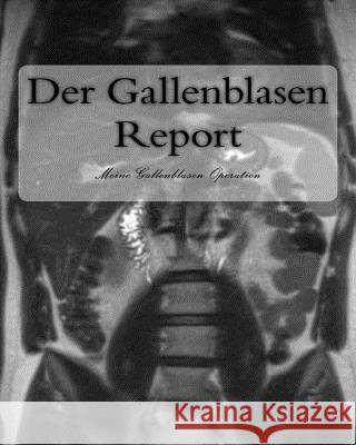 Der Gallenblasen Report: Meine Gallenblasen Operation Thomas Wittmann 9781986085380 Createspace Independent Publishing Platform