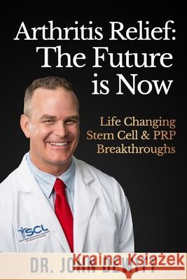 Arthritis Relief: The Future is Now: Life-Changing Stem Cell & PRP Breakthroughs! John DeWitt 9781987571165 Createspace Independent Publishing Platform