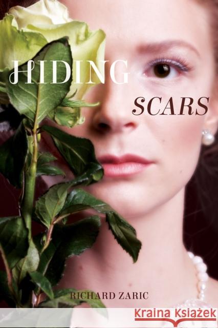 Hiding Scars Richard Zaric   9781988281414 Sands Press