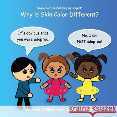 Why Is Skin Color Different? Anjula Evans 9781989803066 Anjula Evans