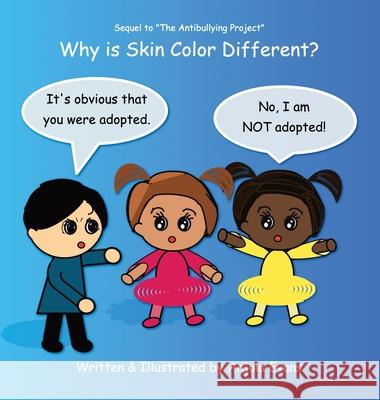 Why Is Skin Color Different? Anjula Evans 9781989803073 Anjula Evans